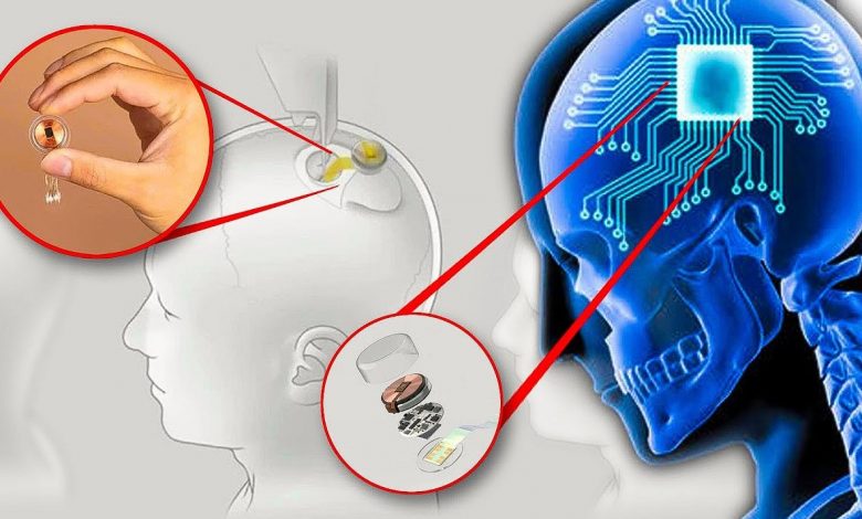 Elon Musk Neuralink Brain Chip